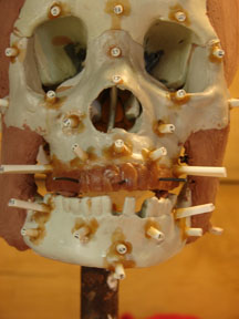 Image of Skull 1104